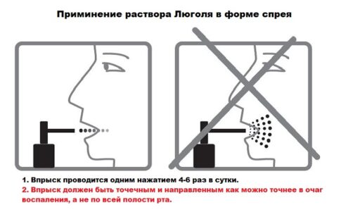 Какое обезболивающее лучше применять при ангине?